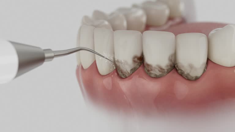 Trusted Dental Crowns And Bridges service in Lapwai, ID - Dentist Open Now